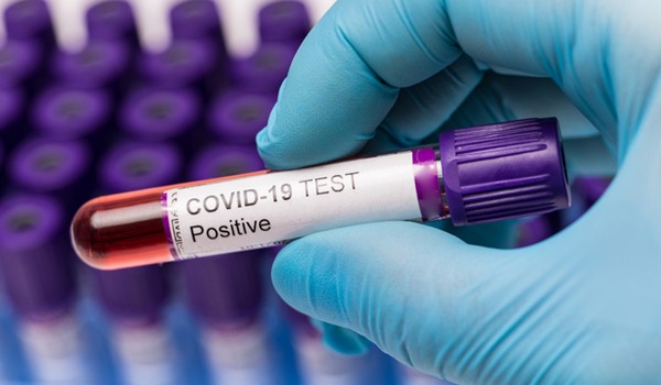 Positive COVID test tube 600